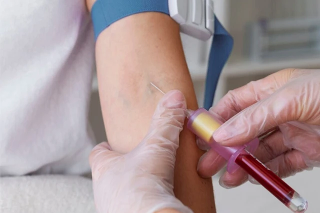 Come fare un test di gravidanza in Giappone: 4 istruzioni de