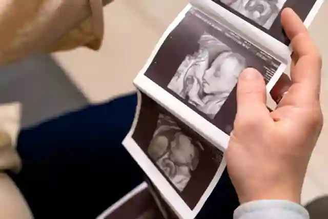 Semana 12 del Embarazo: Guía para Futuras Mamás