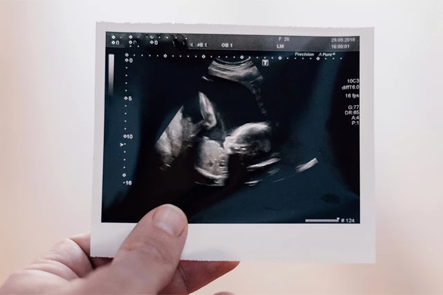 Rahimdeki fetal malformasyonların 12 nedeni