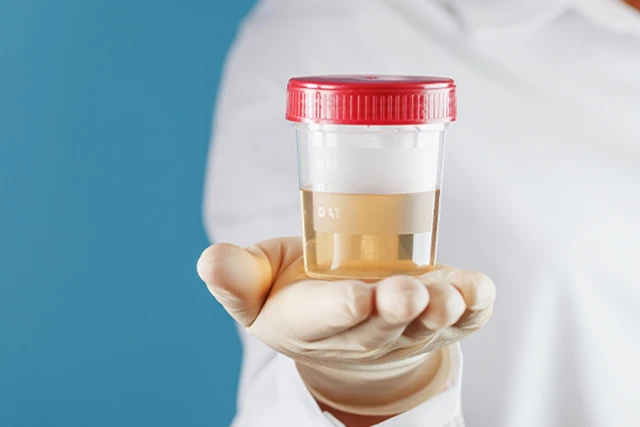 Ile dni jest najwcześniejszy test ciążowy z moczem? Ile dni jest najwcześniejszy test ciążowy z moczem?