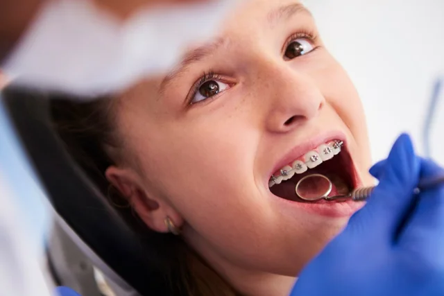 Braces Semasa Hamil: Selamatkah dan Apa Perlu Tahu?