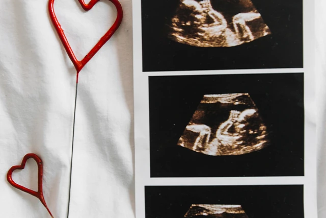 Early Signs of Twin Pregnancy: 7 Signs of Twin Pregnancy