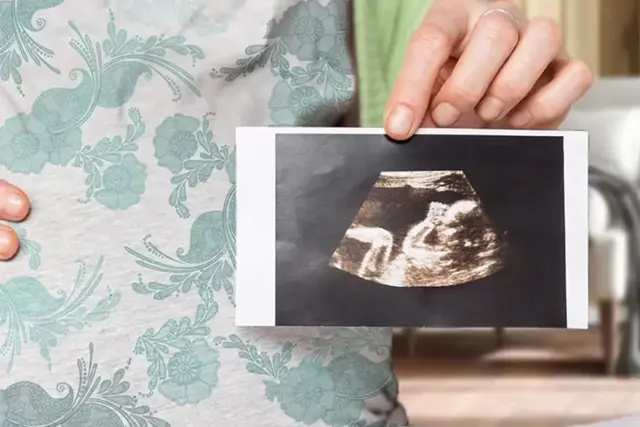 Signs of Pregnancy with a Boy: 20 Earliest Signs