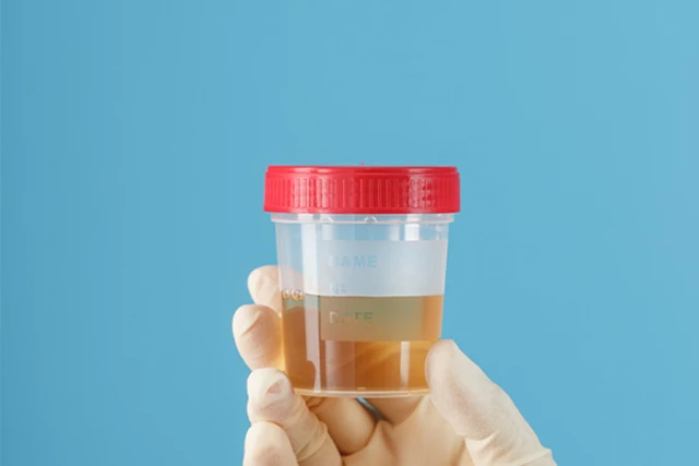 Early Pregnancy Test with Urine: 2 Things to Note Early Pregnancy Test with Urine: 2 Things to Note
