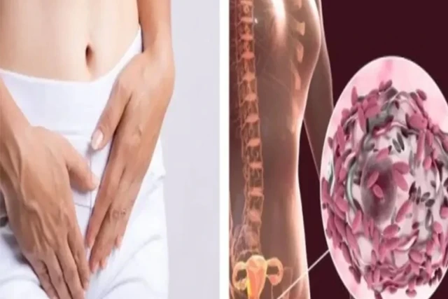 Mẹ Bầu Bị Viêm Phụ Khoa