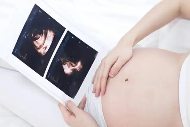 通过手腕判断是否怀孕：7 个事实及其背后的科学依据