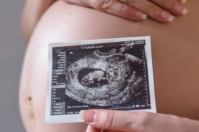 12 causes de malformations fœtales dans l'utérus